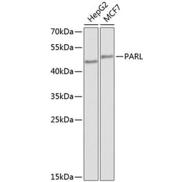 Western Blot - Anti-PARL Antibody (A10355) - Antibodies.com