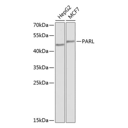 Western Blot - Anti-PARL Antibody (A10355) - Antibodies.com