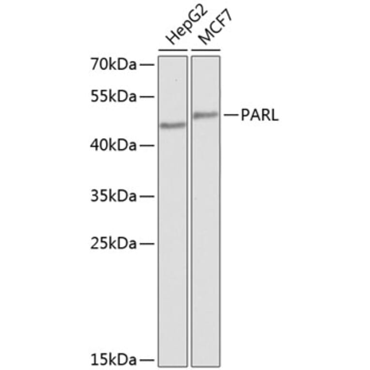 Western Blot - Anti-PARL Antibody (A10355) - Antibodies.com