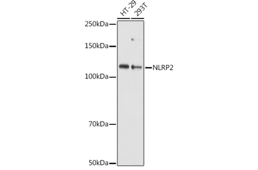 Western Blot - Anti-NALP2 Antibody (A10356) - Antibodies.com