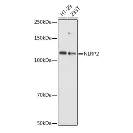 Western Blot - Anti-NALP2 Antibody (A10356) - Antibodies.com