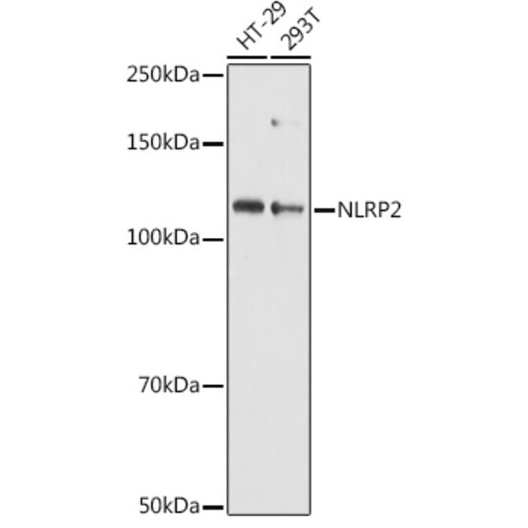 Western Blot - Anti-NALP2 Antibody (A10356) - Antibodies.com