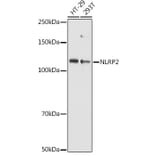 Western Blot - Anti-NALP2 Antibody (A10356) - Antibodies.com