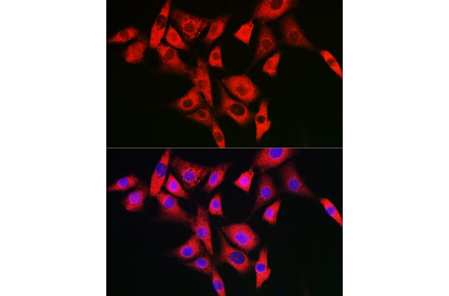 Immunofluorescence - Anti-NALP2 Antibody (A10356) - Antibodies.com