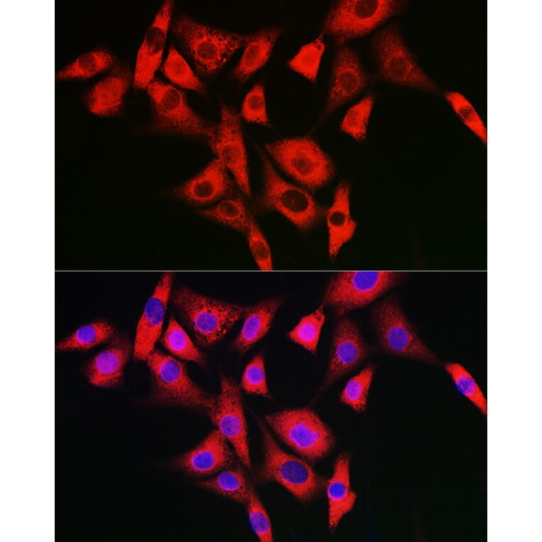 Immunofluorescence - Anti-NALP2 Antibody (A10356) - Antibodies.com