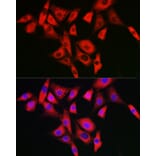 Immunofluorescence - Anti-NALP2 Antibody (A10356) - Antibodies.com