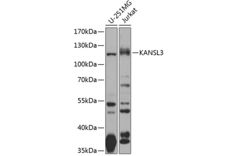 Western Blot - Anti-SI1 Antibody (A10357) - Antibodies.com