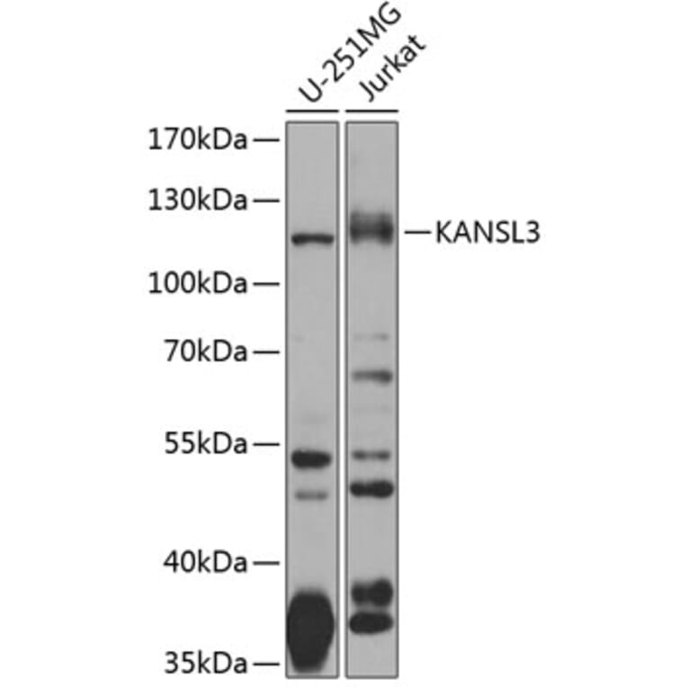 Western Blot - Anti-SI1 Antibody (A10357) - Antibodies.com