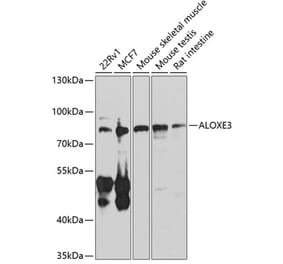 Western Blot - Anti-e-LOX-3 Antibody (A10362) - Antibodies.com