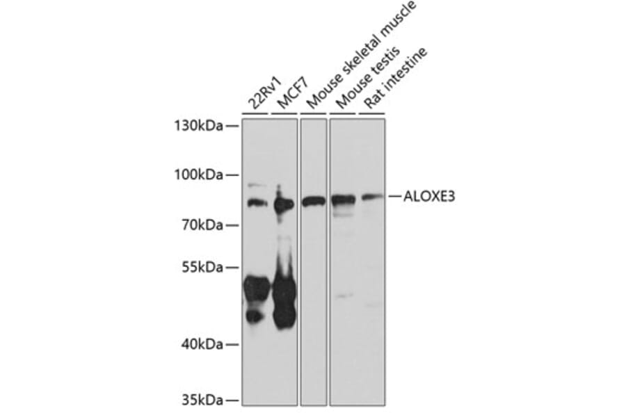 Western Blot - Anti-e-LOX-3 Antibody (A10362) - Antibodies.com