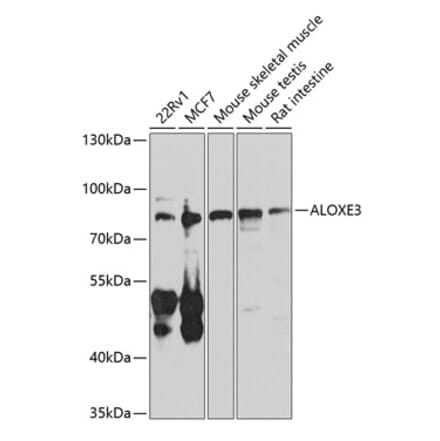 Western Blot - Anti-e-LOX-3 Antibody (A10362) - Antibodies.com