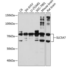 Western Blot - Anti-SLC5A7 Antibody (A10364) - Antibodies.com