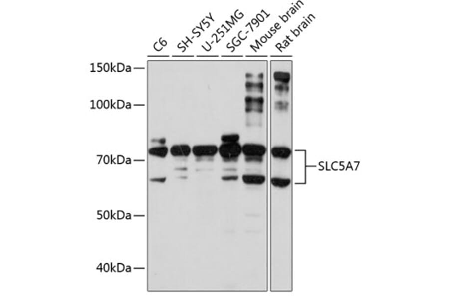 Western Blot - Anti-SLC5A7 Antibody (A10364) - Antibodies.com