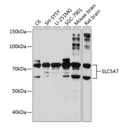 Western Blot - Anti-SLC5A7 Antibody (A10364) - Antibodies.com