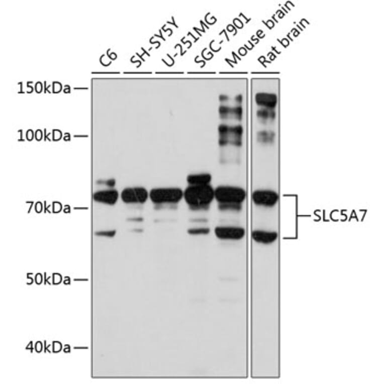 Western Blot - Anti-SLC5A7 Antibody (A10364) - Antibodies.com