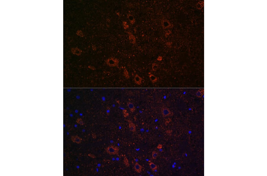 Immunofluorescence - Anti-SLC5A7 Antibody (A10364) - Antibodies.com
