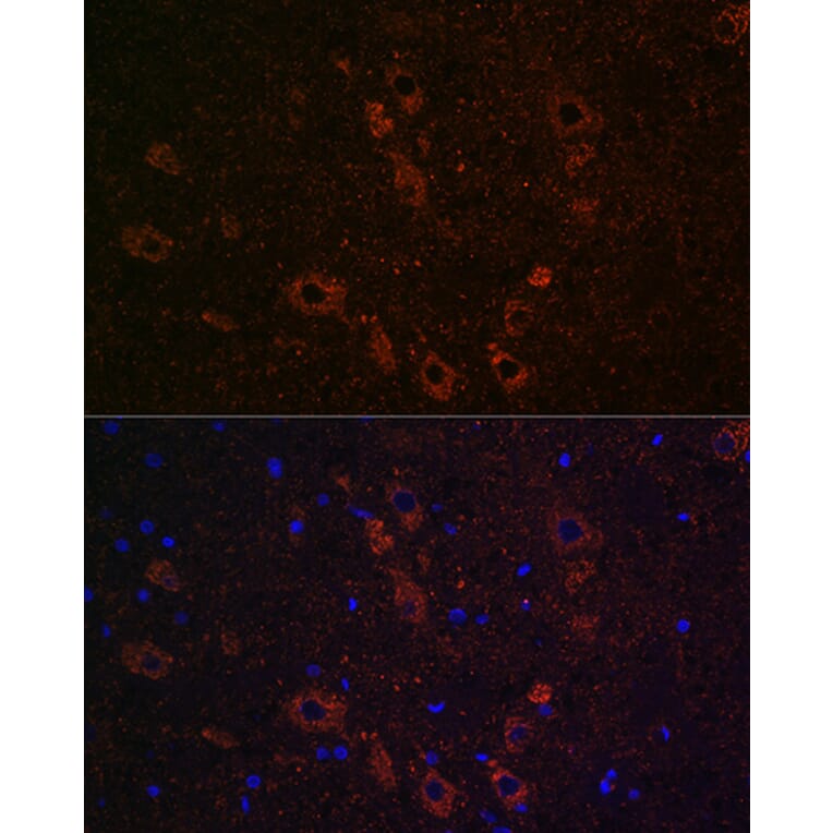 Immunofluorescence - Anti-SLC5A7 Antibody (A10364) - Antibodies.com