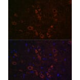 Immunofluorescence - Anti-SLC5A7 Antibody (A10364) - Antibodies.com