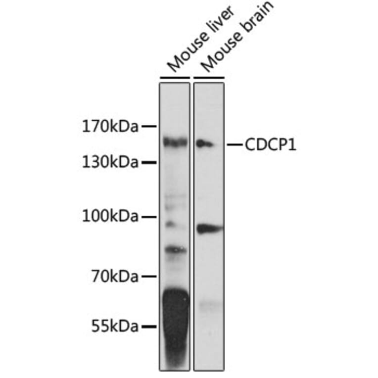 Western Blot - Anti-CDCP1 Antibody (A10366) - Antibodies.com