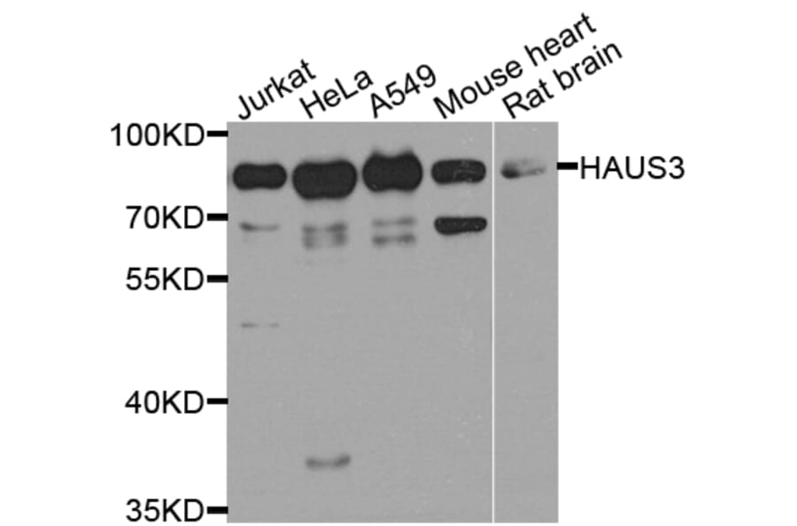 Western Blot - Anti-HAUS3 Antibody (A8258) - Antibodies.com