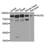 Western Blot - Anti-HAUS3 Antibody (A8258) - Antibodies.com