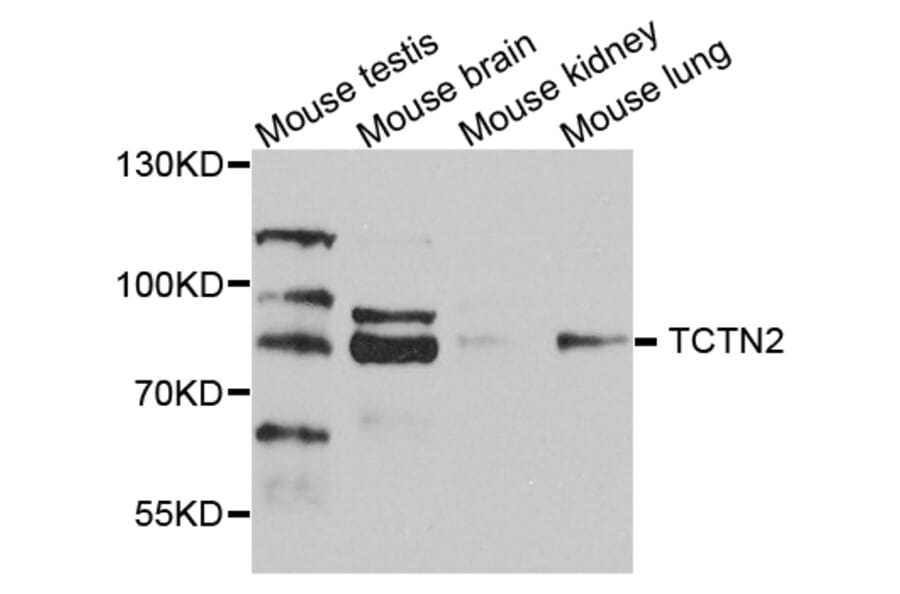 Western Blot - Anti-TCTN2 Antibody (A8260) - Antibodies.com