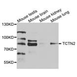 Western Blot - Anti-TCTN2 Antibody (A8260) - Antibodies.com