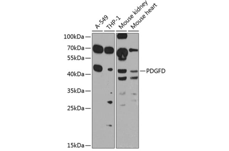 Western Blot - Anti-SCDGFB/PDGF-D Antibody (A10370) - Antibodies.com