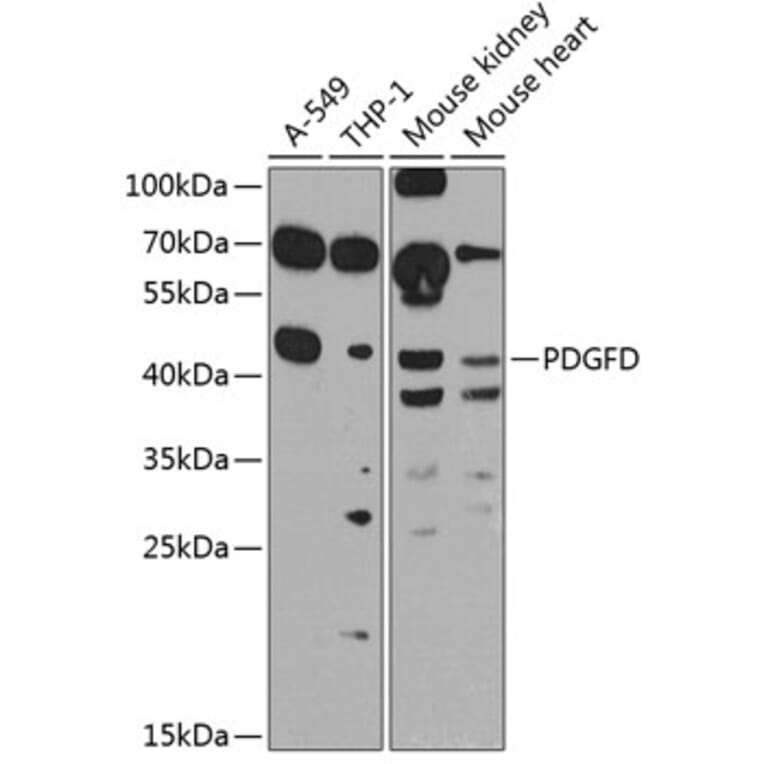 Western Blot - Anti-SCDGFB/PDGF-D Antibody (A10370) - Antibodies.com