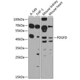 Western Blot - Anti-SCDGFB/PDGF-D Antibody (A10370) - Antibodies.com