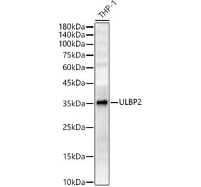 Western Blot - Anti-ULBP2 Antibody (A10371) - Antibodies.com