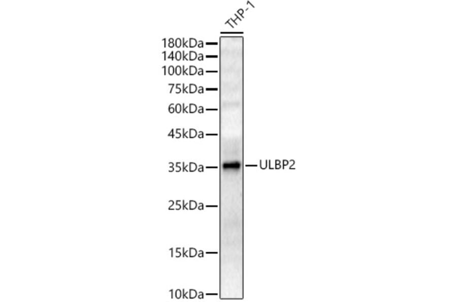 Western Blot - Anti-ULBP2 Antibody (A10371) - Antibodies.com