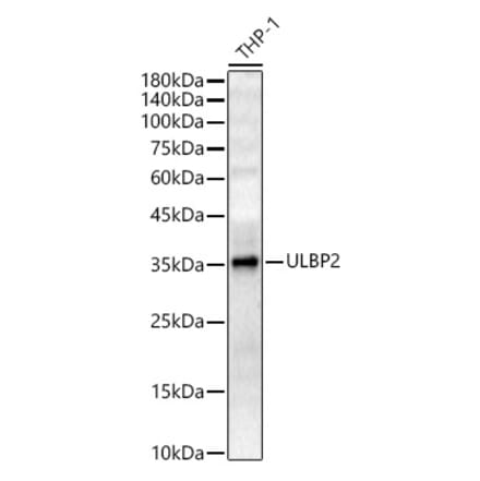 Western Blot - Anti-ULBP2 Antibody (A10371) - Antibodies.com