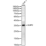 Western Blot - Anti-ULBP2 Antibody (A10371) - Antibodies.com