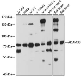 Western Blot - Anti-ADAM33 Antibody (A8265) - Antibodies.com
