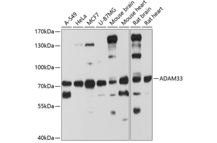 Western Blot - Anti-ADAM33 Antibody (A8265) - Antibodies.com