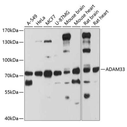 Western Blot - Anti-ADAM33 Antibody (A8265) - Antibodies.com