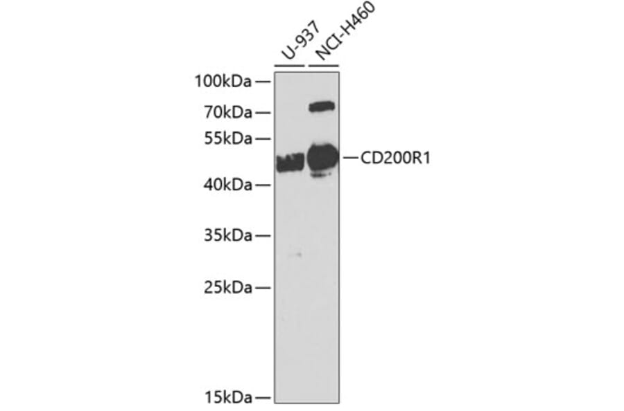 Western Blot - Anti-CD200R Antibody (A10379) - Antibodies.com
