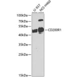 Western Blot - Anti-CD200R Antibody (A10379) - Antibodies.com