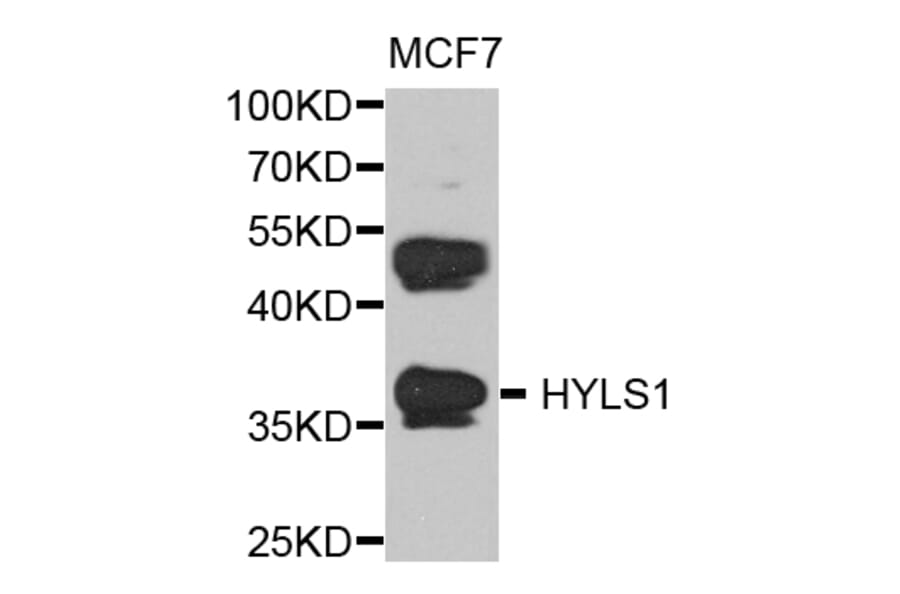 Western Blot - Anti-HYLS1 Antibody (A8285) - Antibodies.com
