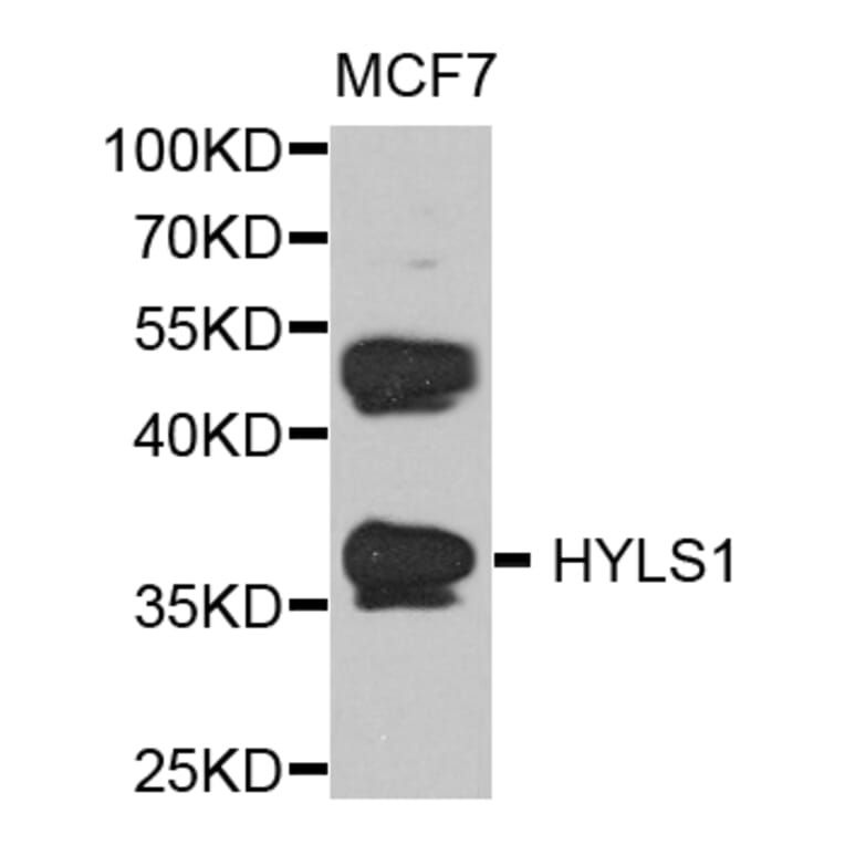 Western Blot - Anti-HYLS1 Antibody (A8285) - Antibodies.com