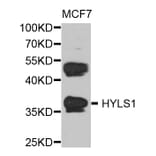 Western Blot - Anti-HYLS1 Antibody (A8285) - Antibodies.com