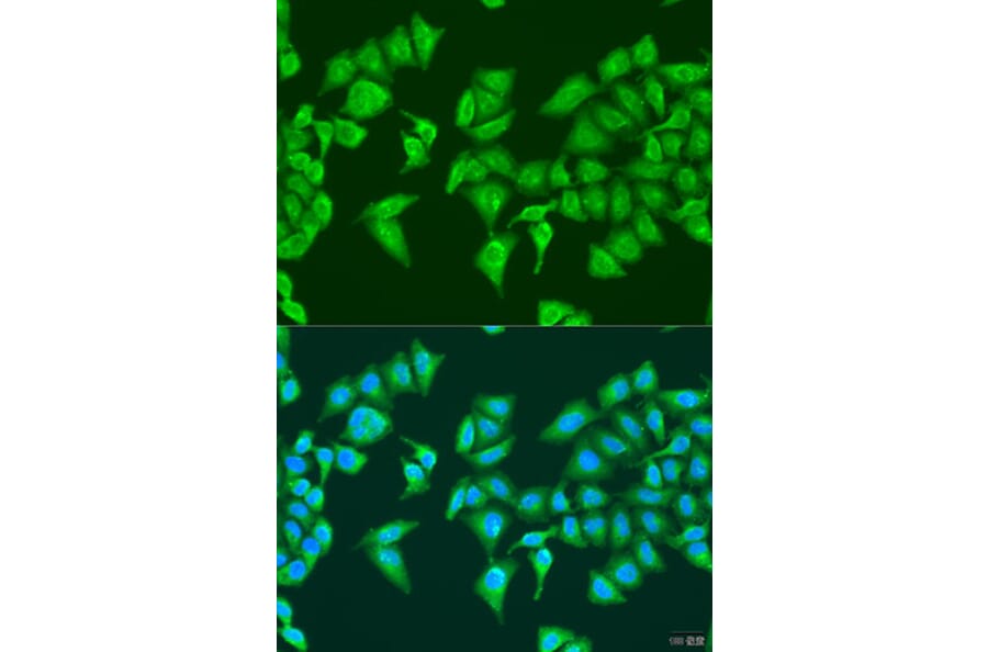Immunofluorescence - Anti-HYLS1 Antibody (A8285) - Antibodies.com