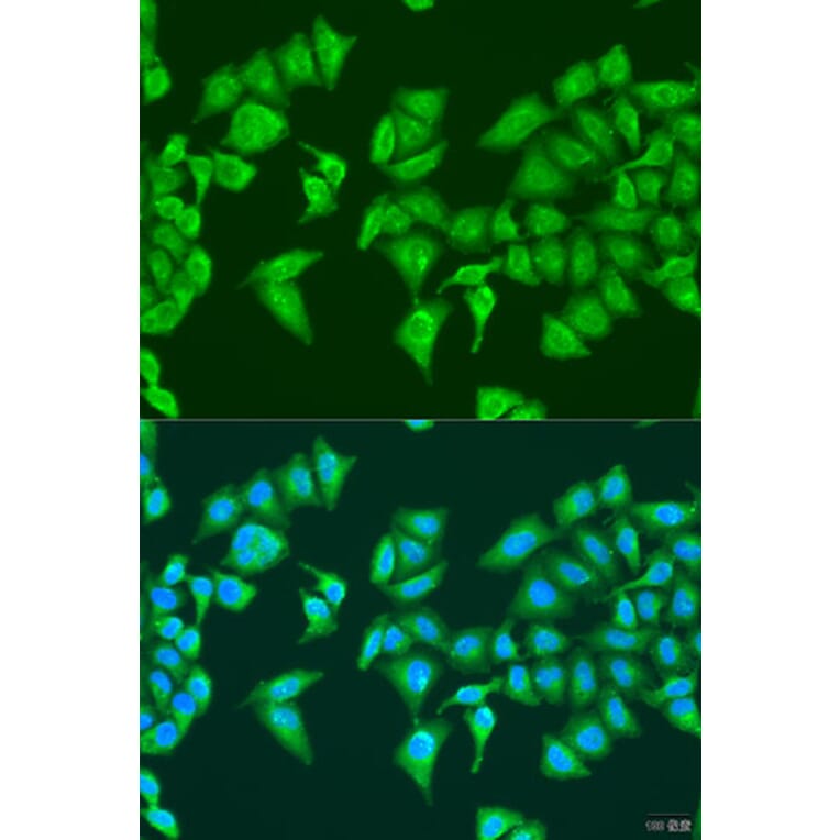 Immunofluorescence - Anti-HYLS1 Antibody (A8285) - Antibodies.com