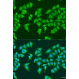 Immunofluorescence - Anti-HYLS1 Antibody (A8285) - Antibodies.com