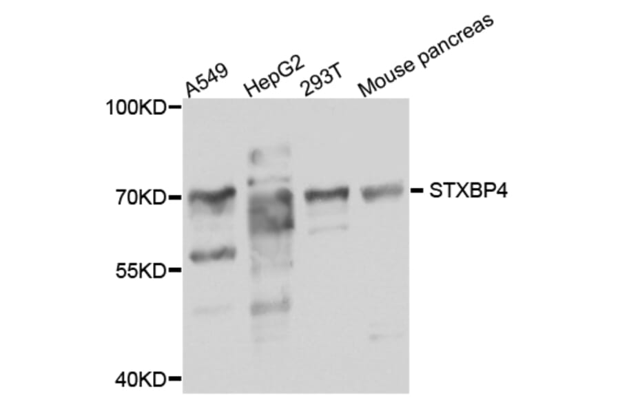 Western Blot - Anti-STXBP4 Antibody (A8287) - Antibodies.com