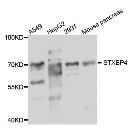 Western Blot - Anti-STXBP4 Antibody (A8287) - Antibodies.com