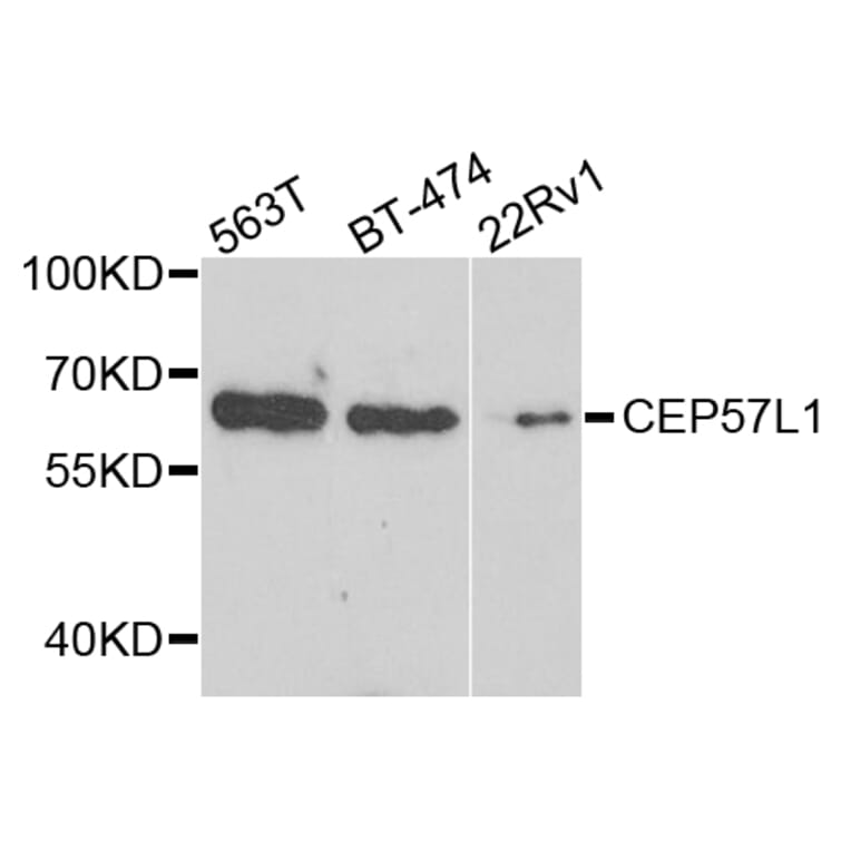 Western Blot - Anti-CEP57L1 Antibody (A8290) - Antibodies.com