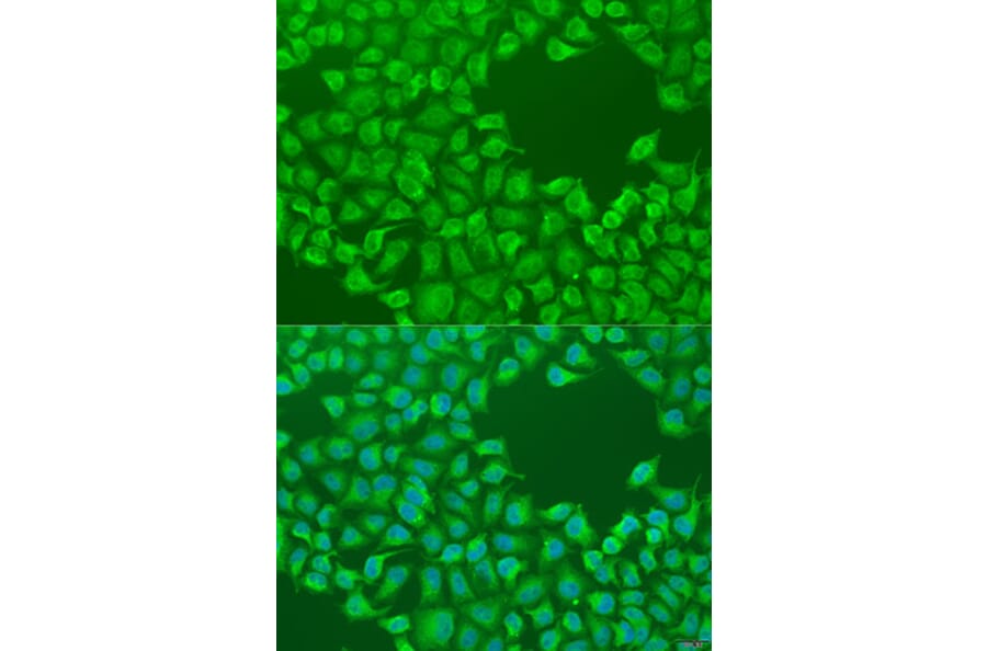 Immunofluorescence - Anti-CEP57L1 Antibody (A8290) - Antibodies.com