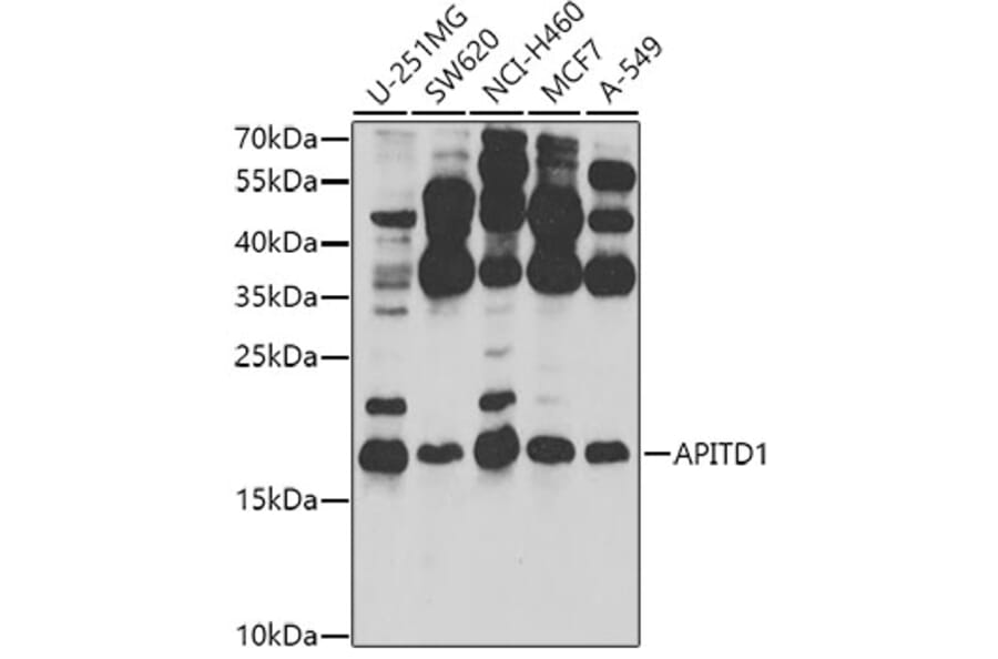 Western Blot - Anti-MHF1 Antibody (A10387) - Antibodies.com